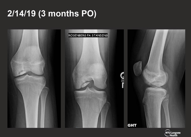 Cartilage Case of the Month - KM