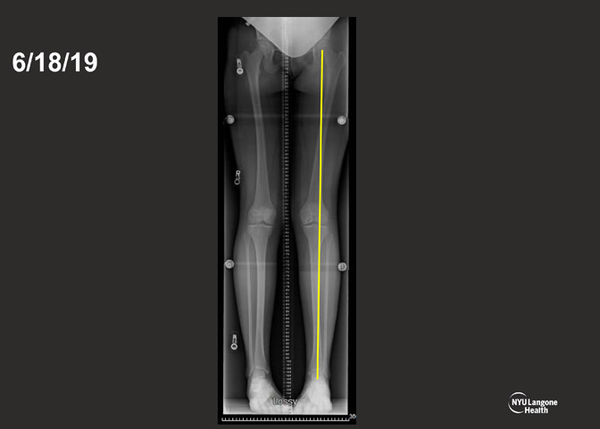 Cartilage Case of the Month - KM